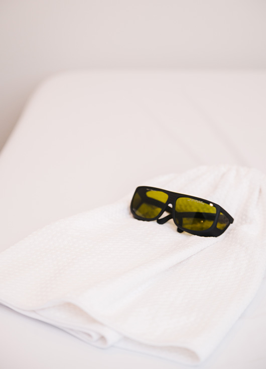 laser hair removal